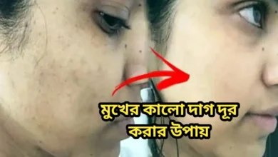 মুখের কালো দাগ দূর করার উপায়